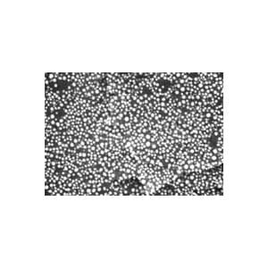 Very High Resolution Au-C Test on JEOL Stub