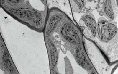Succeed your sample preparation in Microscopy