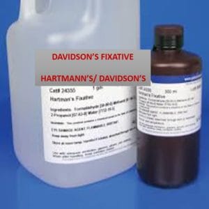 Davidson's Fixative (Hartmann's/ Davidson's) Davidson's Fixative (Hartmann's/ Davidson's)