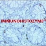 ImmunoHistoZyme™, Ready-to-Use