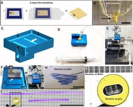 A targeted 3D EM and correlative microscopy method using SEM array tomography