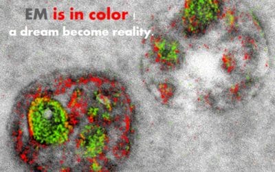 Electron Micrographs Get a Dash of Color … from the Scientist mag.