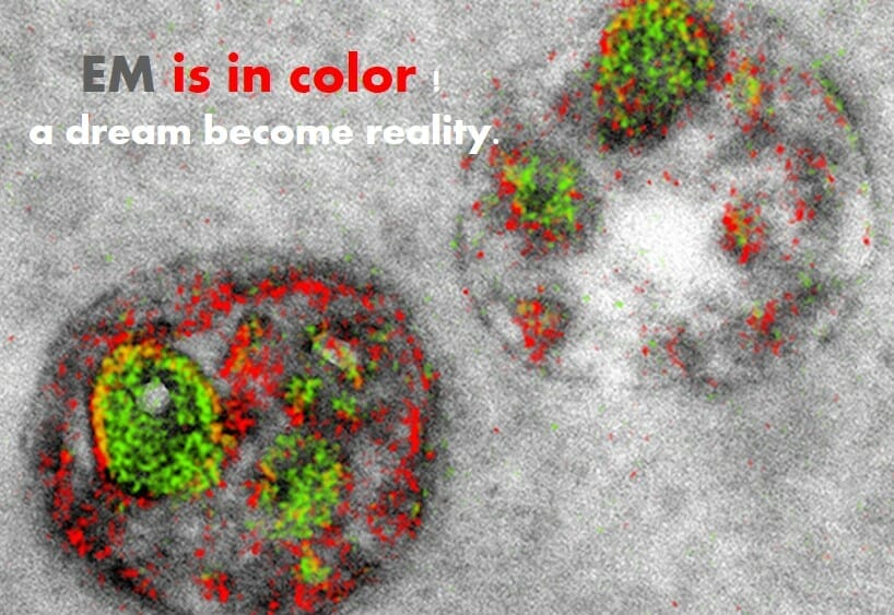 Electron Micrographs Get a Dash of Color … from the Scientist mag.