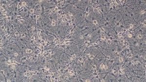 Rat Tail Type I Collagen Coated German Glass Cover Slips