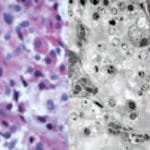 Fluorophore-Infiltrated Resin Microscopy (FIRM)