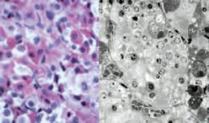 Fluorophore-Infiltrated Resin Microscopy (FIRM)