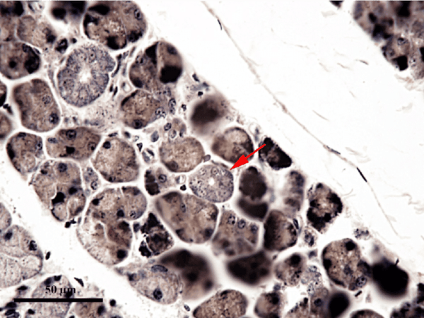 Hematoxylin Solution & Heidenhain’s Hematoxylin