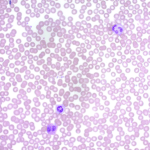 Jenner Stain Solution