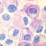 Ehrlich's Hematoxylin