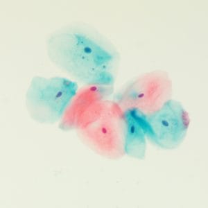 EA Counterstain, Gill's Modified Solution