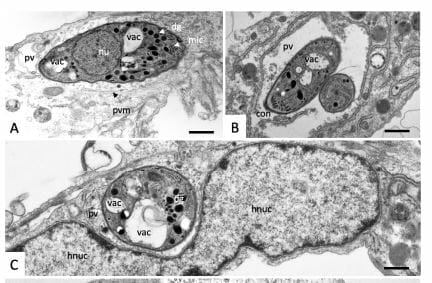 uranyless used  in EM stain  infection analysis  for Malaria and some parasites that affect humans and animals.
