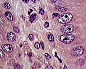 Alum Hematoxylin Solution