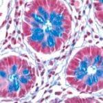 Light Green SF Yellowish Solution