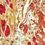  Modified Movat's Stain