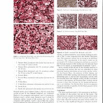 Wilder Modification of Bielschowsky's Method
