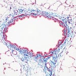 Masson's Trichrome for Connective Tissue