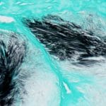 Gomori's Methenamine Silver for Urate Crystals