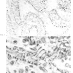 Puchtler-Sweat Method for Basement Membranes