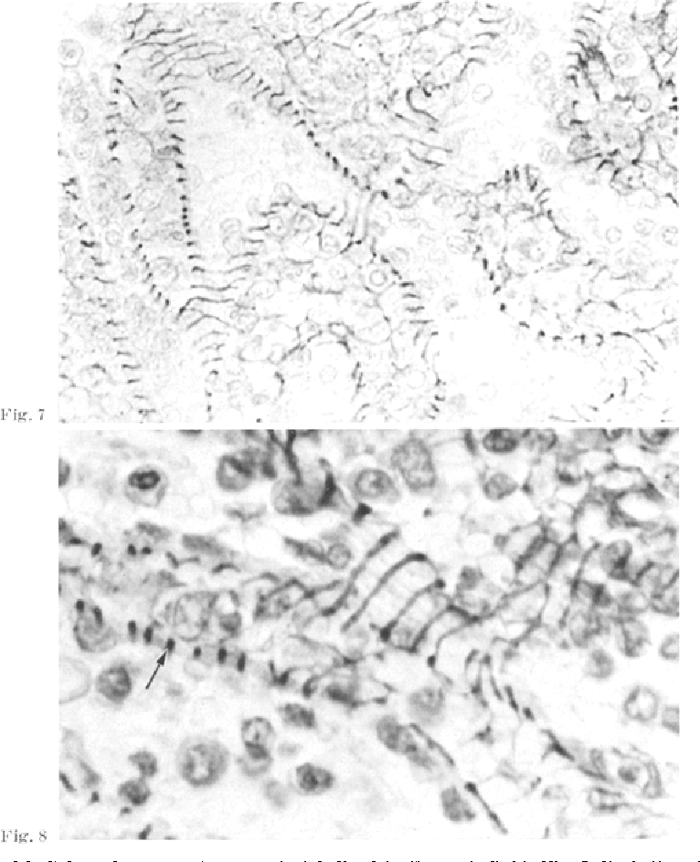 Puchtler-Sweat Method for Basement Membranes