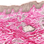 Van Gieson's & Mallory Method for Collagen Fibers