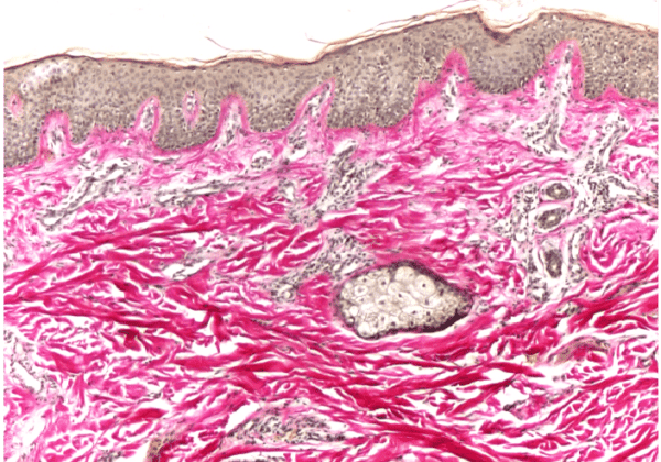 Van Gieson's & Mallory Method for Collagen Fibers