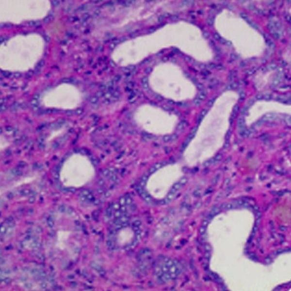 Eosin-Phloxine Counterstain