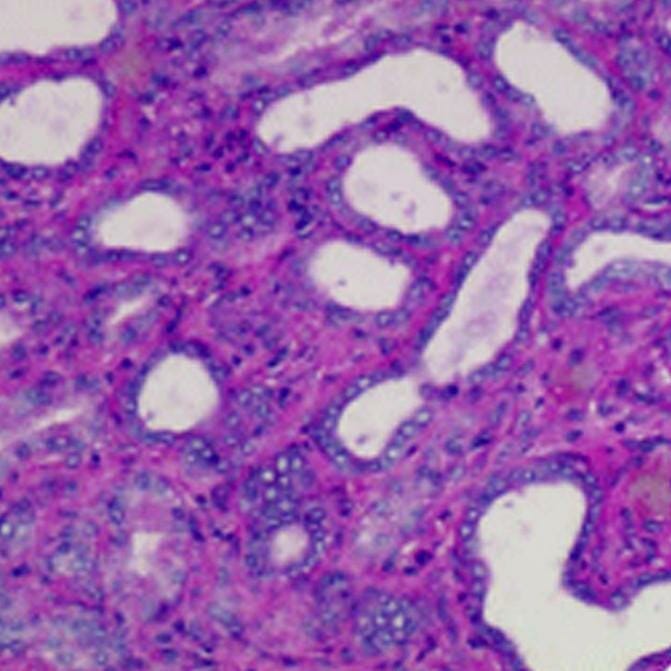 EosinPhloxine Counterstain Delta Microscopies