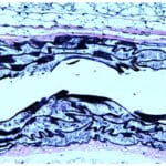 Verhoeff's Van-Gieson's (VVG Method)
