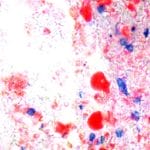 Oil Red O Method for Lipofuscin