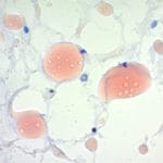 Fat Stains in Supersaturated Alcohol