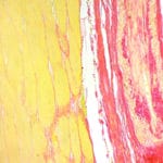 Picrosirius Red Staining of Cardiac