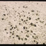 Lillie's Method for Iron