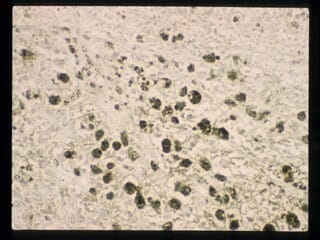 Lillie's Method for Iron