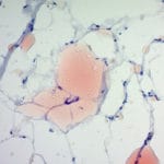 Oil Red in Propylene Glycol Method