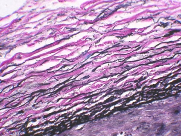 Weigert's Resorcin Fuchsin