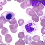 Toren's Method for Mastocytes