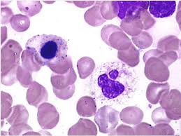 Toren's Method for Mastocytes