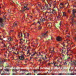 Maldonado's Method For Pancreatic Islet Cells