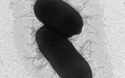 Negative EM Stain77