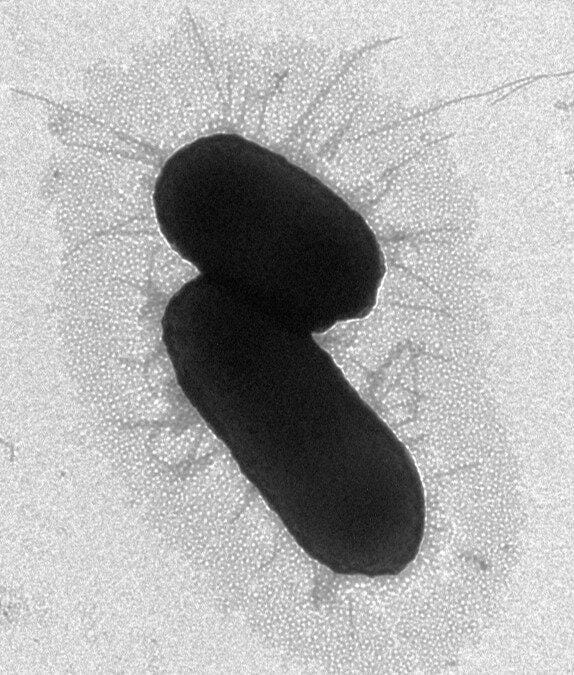 Negative EM Stain77